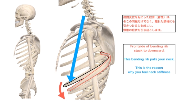 胸椎の屈曲による頚椎の緊張