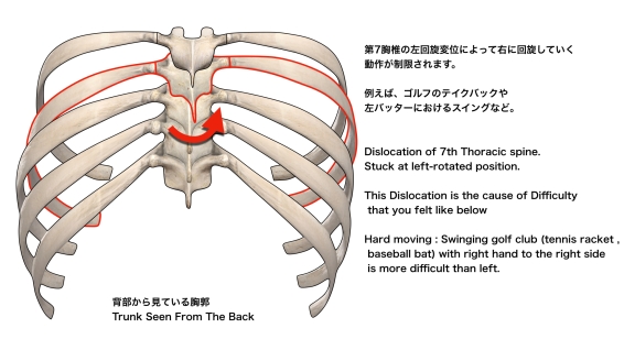 胸椎の回旋異常